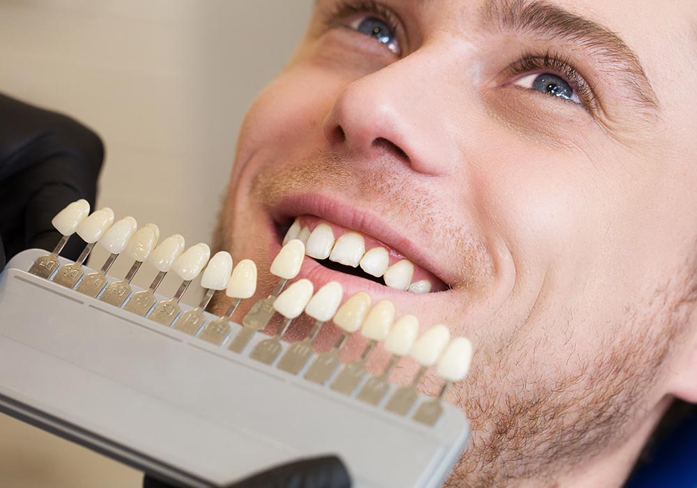 Bespoke Veneers Clyde Munro Keeping Scotland Smiling