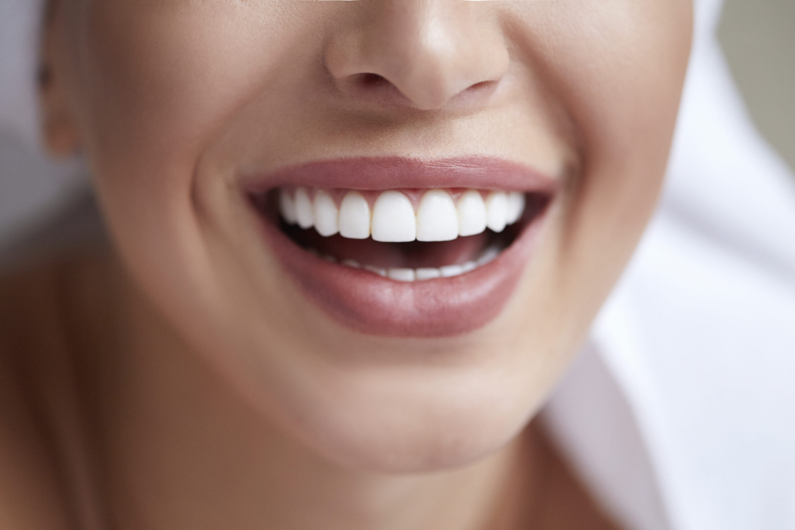 Close-up image of a woman's smile showing white teeth and natural lips.