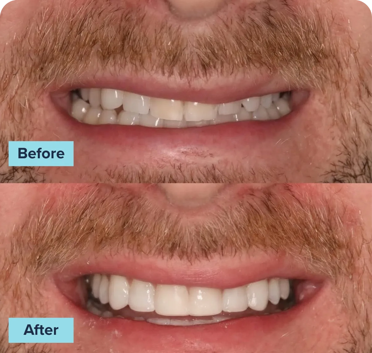 BeforeAfterComp11 (1)