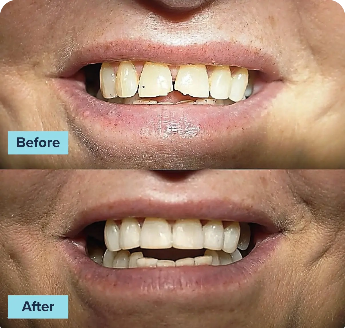 BeforeAfterComp22 (2)